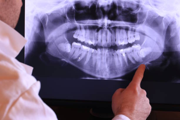 Best Urgent Tooth Repair  in Maineville, OH