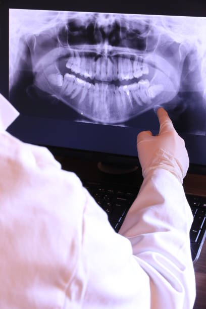 Best Dentist for Tooth Abscess  in Maineville, OH