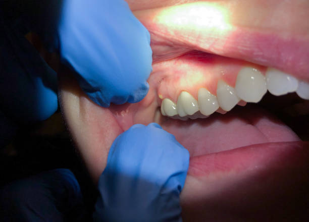 Best Emergency Gum Pain Relief  in Maineville, OH