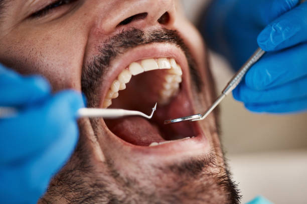 Dentist for Dental Trauma in OH